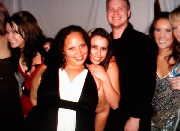 fat arm
