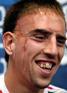 franck yuck