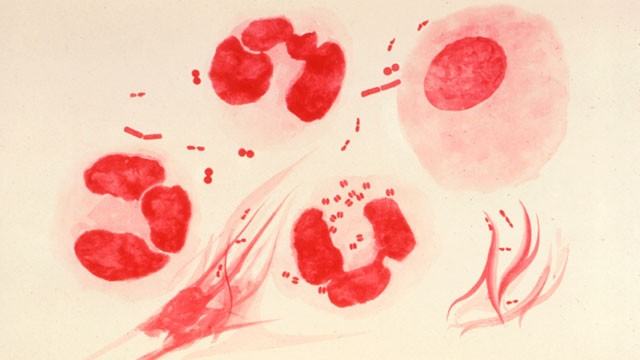 gty_gonorrhea_sc_110708_wg