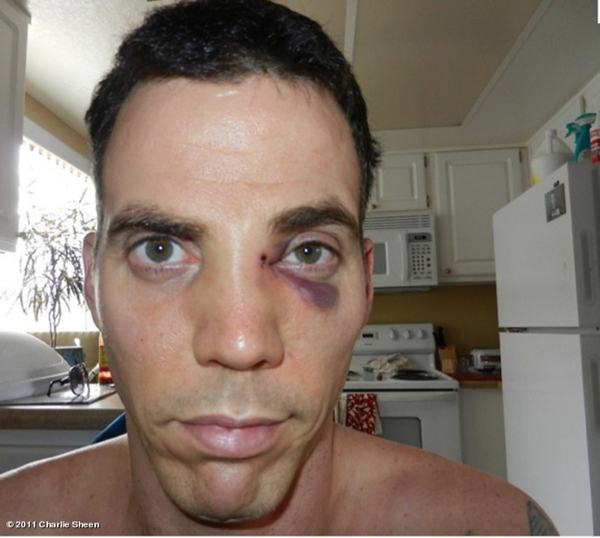 steveo